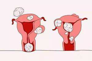 �����׷���������ʲôԭ��