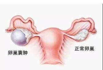 �ѳ����׿������˶�����ʲô�˶��ã�